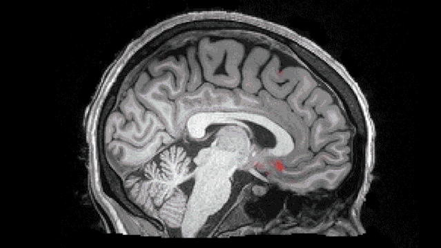 注意！只有睡眠可清扫你脑中的垃圾！睡眠不足会让人变傻、变痴呆