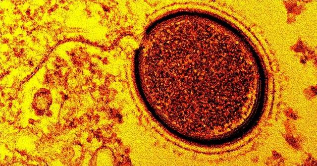 北极发现5.7万年前尸体，可能还会出现更危险的东西，人类需警醒