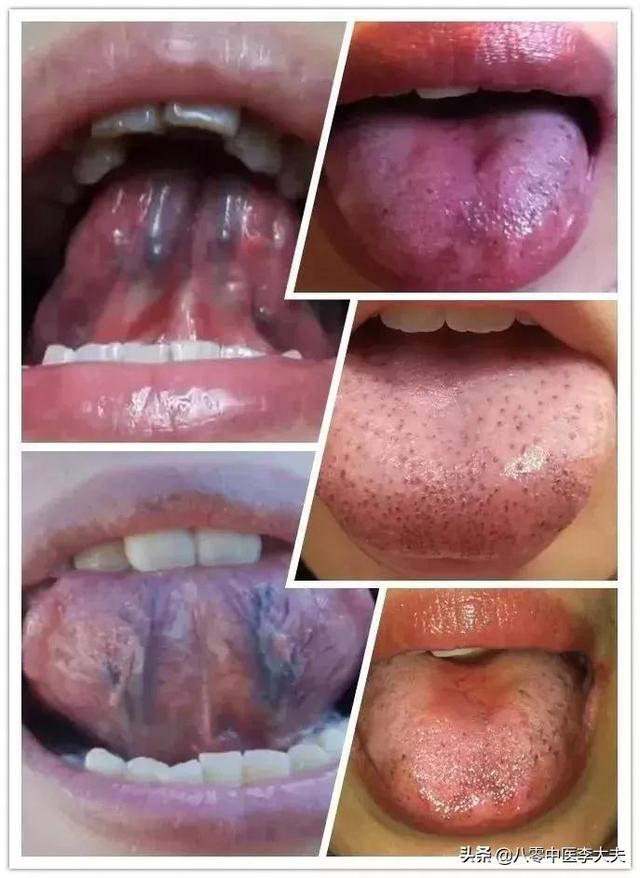 脸上有黑点，胸口针扎一样疼，眼圈发黑，嘴唇发黑，是瘀血造成的