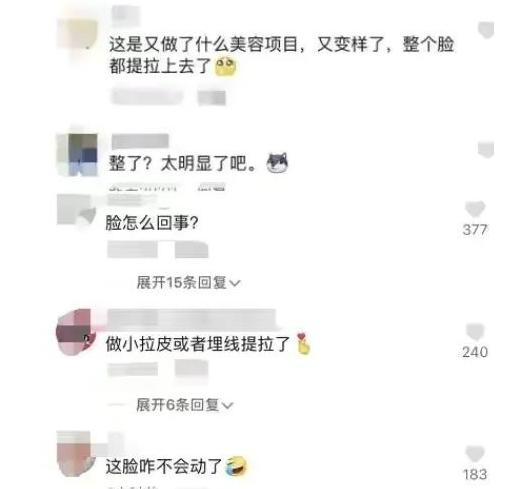 3月才开始，10位明星接连被曝“脸崩”，让61岁的蔡明情何以堪？