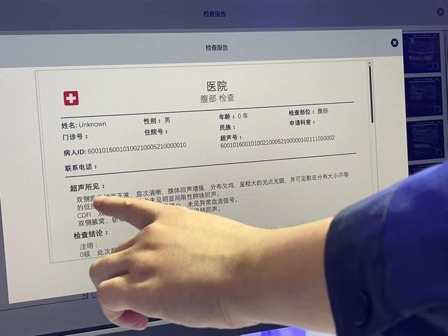 通过进博会上的这台5G超声机器人，我远程找到了“患者”的恶性肿瘤