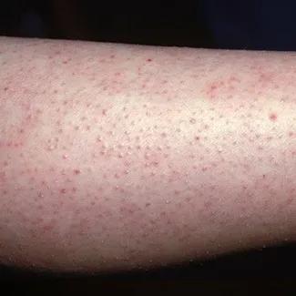 果酸身体乳能保湿