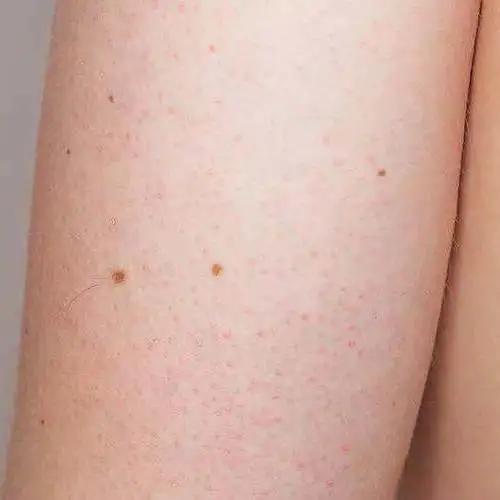 推荐秋冬季保湿不黏腻的身体乳 推荐秋冬季保湿不黏腻的身体乳