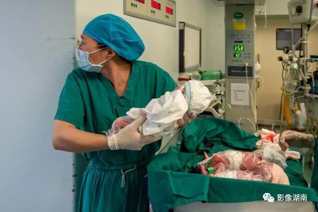 世界早产儿日不用怕，早到的天使