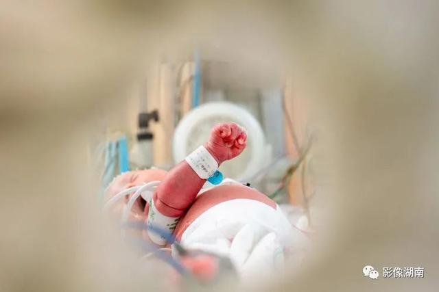 世界早产儿日不用怕，早到的天使