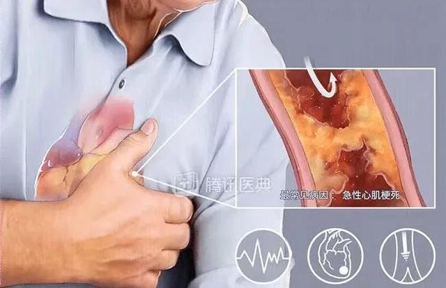 经常吸二手烟对于冠心病患者的危害有哪些？