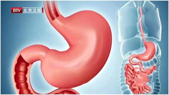 胃不好的人注意了，6种食物医生都劝你少吃！这些才是真正的养胃法，早学早受益