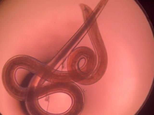 宝宝眼睛里长了虫，或因家里养了宠物