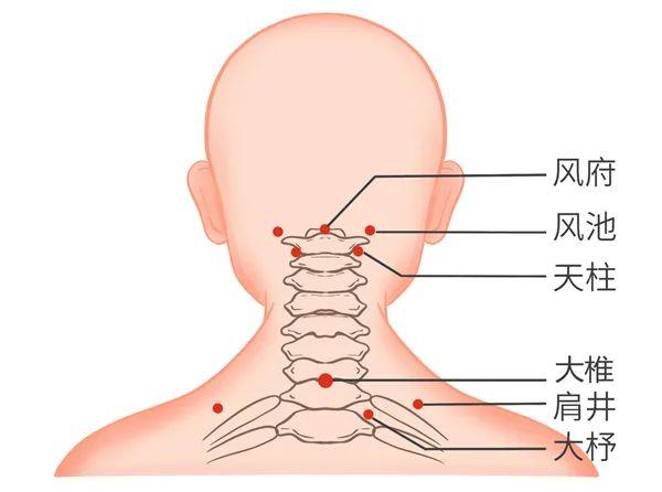 颈椎如何保健？注意这三个方面