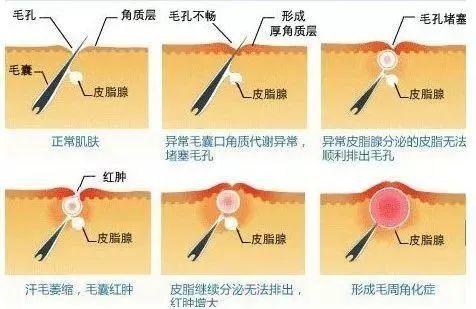 治疗鸡皮肤案例