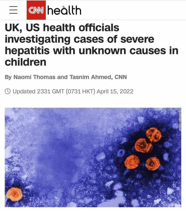 欧洲多国相继报告儿童不明原因急性肝炎 欧洲疾控中心：确切原因尚不清楚