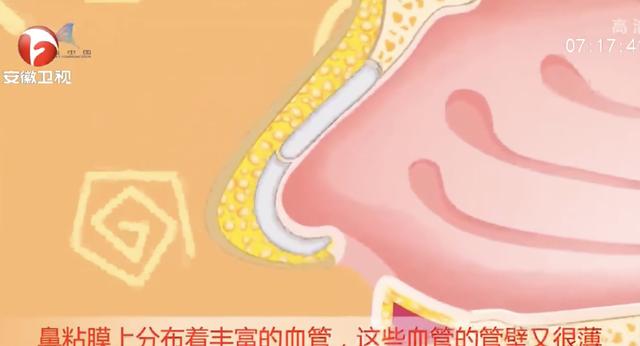 为什么不能挖鼻孔？挖鼻孔会带来3个不良后果