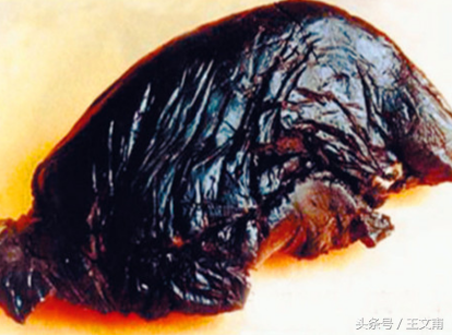 请问阿片毒品类有什么，阿片类毒品主要有()（阿片类毒品包括什么）