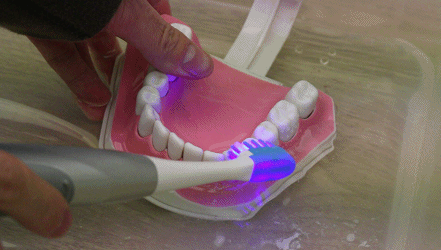 LED蓝光杀菌美白牙齿 GOSMILE声波电动牙刷评测