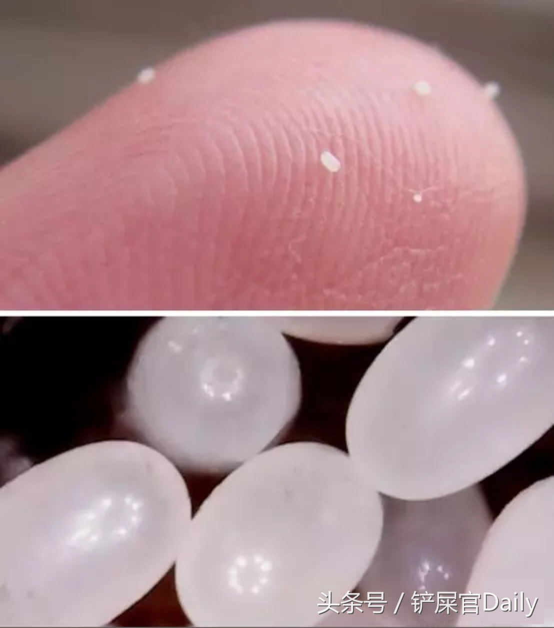 宠物常见寄生虫之难缠的跳蚤(上)