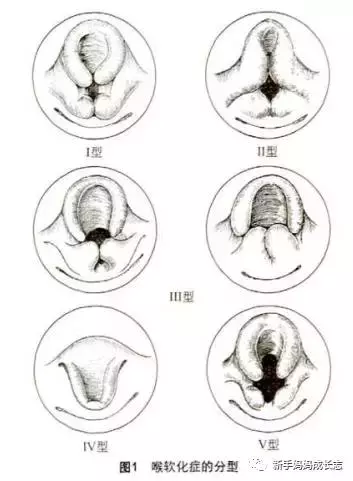 您的孩子被诊断为喉软化？听听儿科大夫怎么说