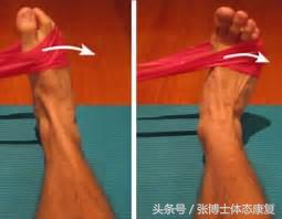 体态康复问答｜矫正O型腿训练，大家看看有同样的问题吗？