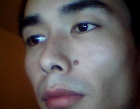 阳明道长口述:鼻梁上有痣代表什么?