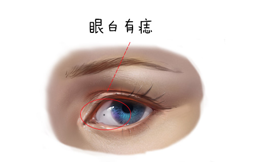 脸上这几颗痣最好不要有，情路坎坷易二婚