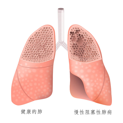 抽烟的時候不怎麽咳嗽，戒烟了怎么还咳嗽变多呢？