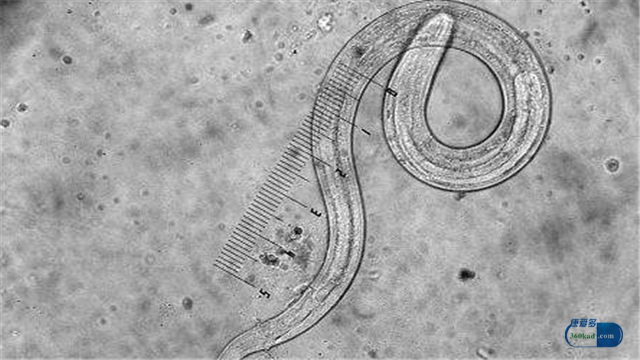 哪些症状说明身体里存在蛔虫？肠虫清的治疗作用怎样？