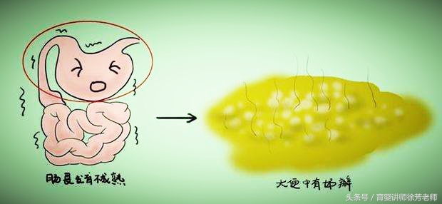 徐老师讲育儿咨询故事：宝宝大便酸菜味，咋回事捏？