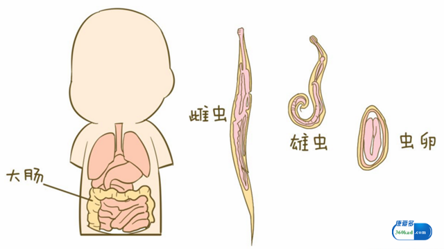 哪些症状说明身体里存在蛔虫？肠虫清的治疗作用怎样？