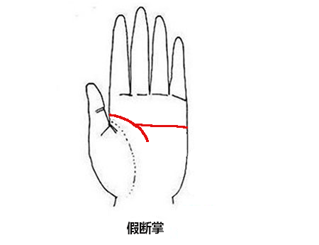 民间有关断掌的说法很多,具有代表性的是:断掌的人不能打人,断掌的