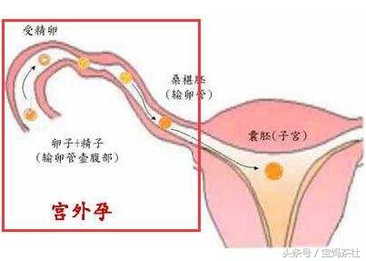 试管婴儿究竟要花多少钱？受多少罪？让你全面了解试管婴儿