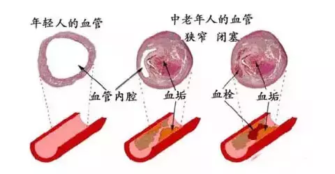 不花一分钱，看手就能知道身体哪里出了问题！