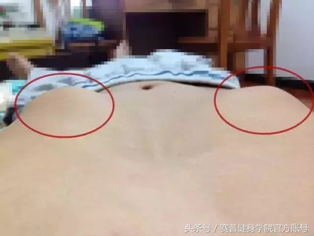 你也肋骨外翻？不知道怎么矫正？
