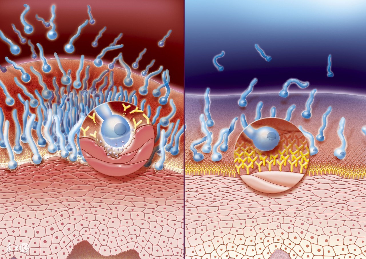 钞票也会传播性病？女性患性病有这些症状