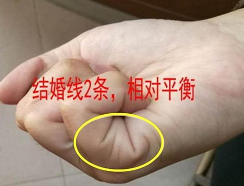 手上没有婚姻线就不能结婚吗？婚姻线的数量代表什么？