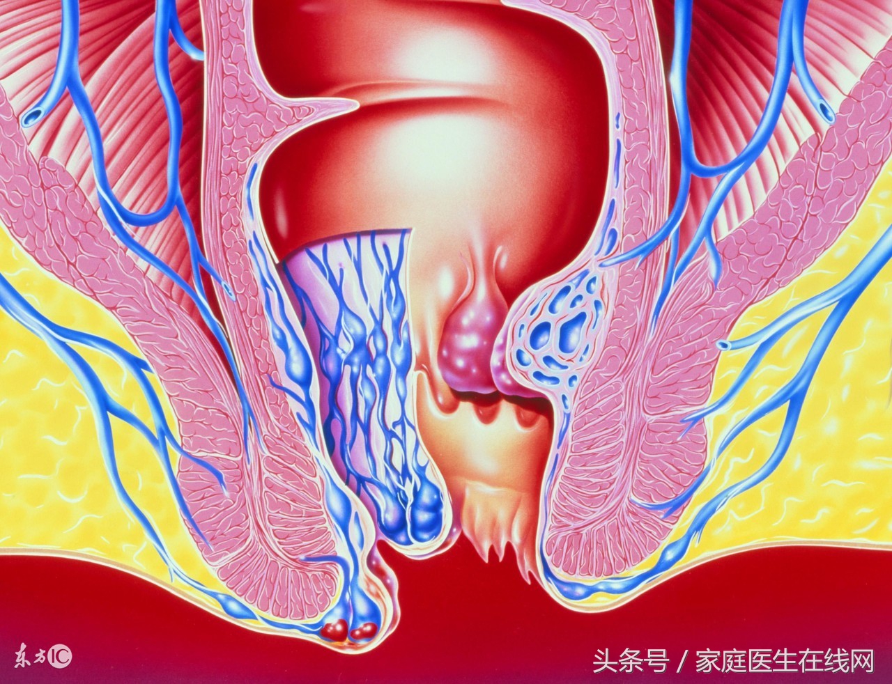 为什么肛门附近湿湿的？5招提肛运动养护肛门