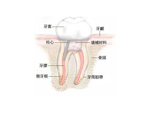 什么时候需要给牙齿做根管治疗？要做几次？需要多长时间？