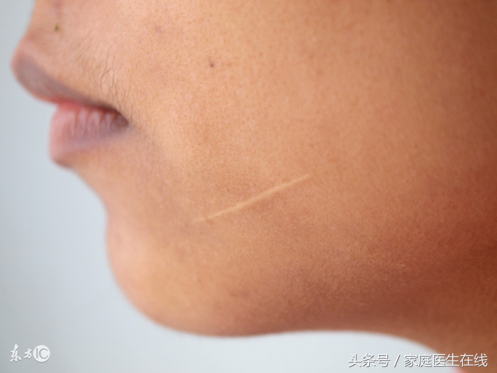 有效去除疤痕，恢复光滑肌肤，重拾自信外观