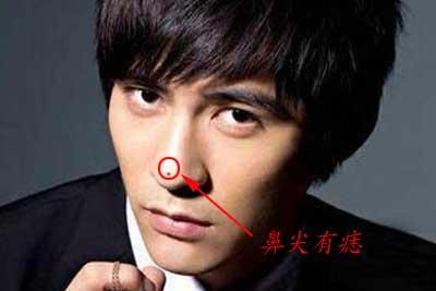 鼻尖上长痣到底好不好?