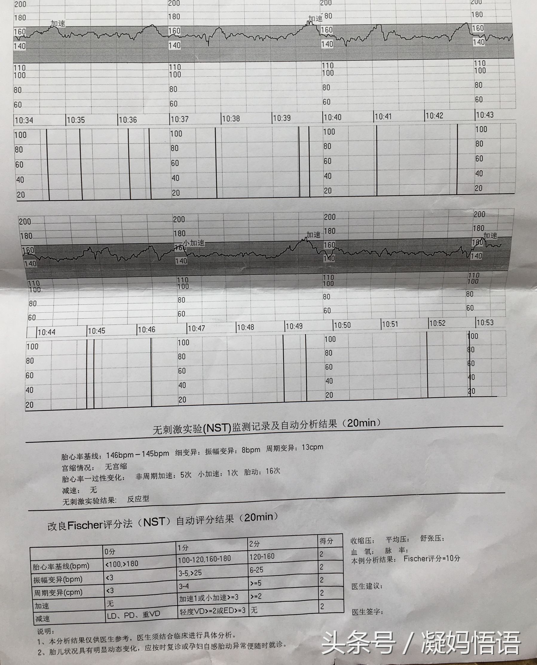 三次胎心监护结果分享：几个小心得，教你胎心监护做到10分