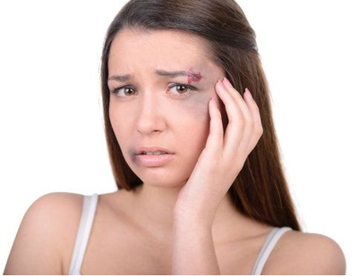 皮肤莫名其妙出现青紫瘀斑?满足三个症状,可能就是血瘀体质!