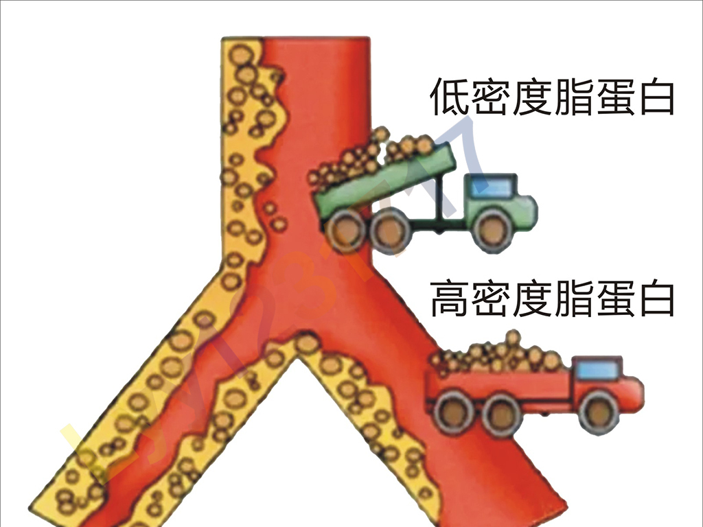 你知道血脂四项的，秘密吗？