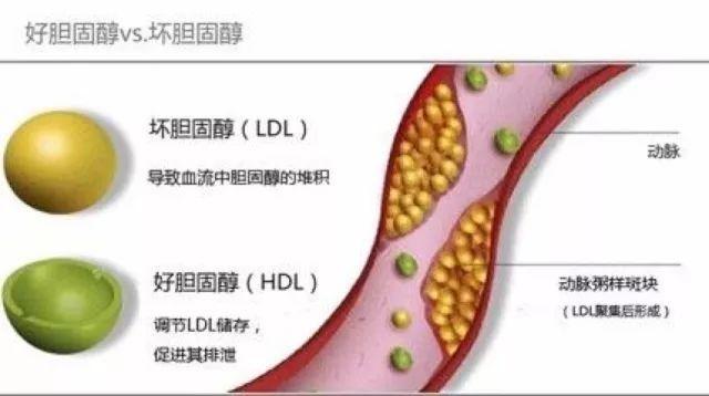 你知道血脂四项的，秘密吗？