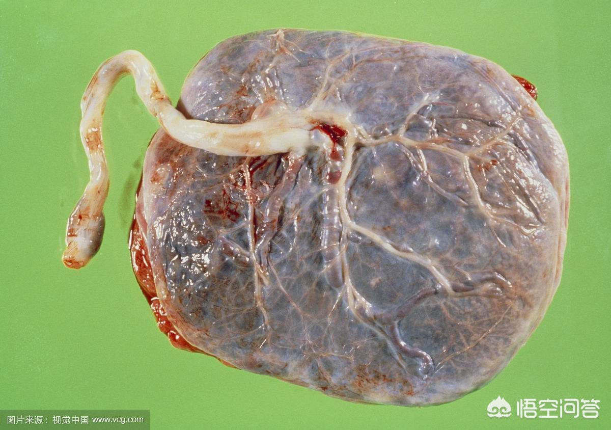 婴儿胎盘怎么处理胎盘一般是如何处理的呢