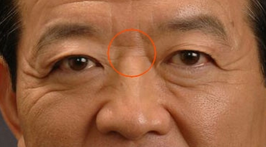 山根有横纹肠胃弱,山根有痣爽不起(你懂的)