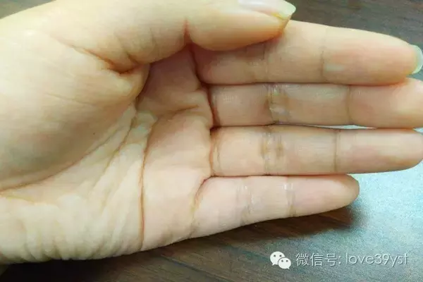 观手知健康 只要一分钟 就知道你身体的秘密