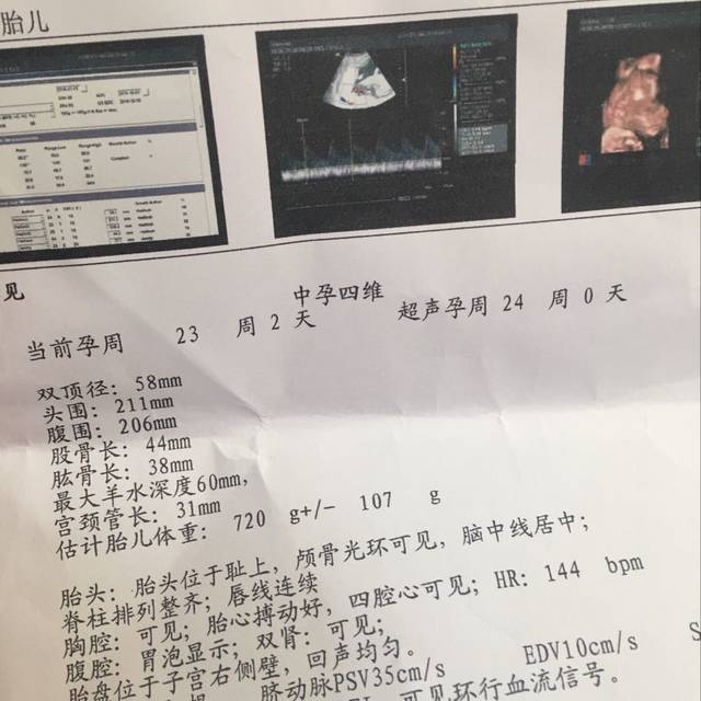 23周四维通过，确定是男宝，附怀男的一些特征，宝妈们都有吗