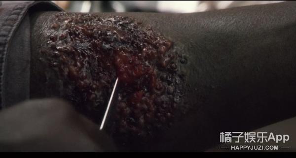 友情提示：密集恐惧者慎入