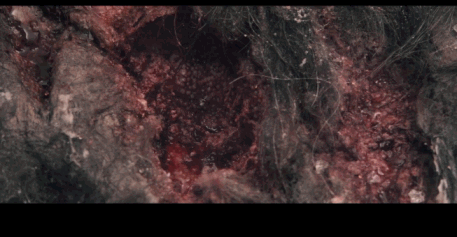 友情提示：密集恐惧者慎入