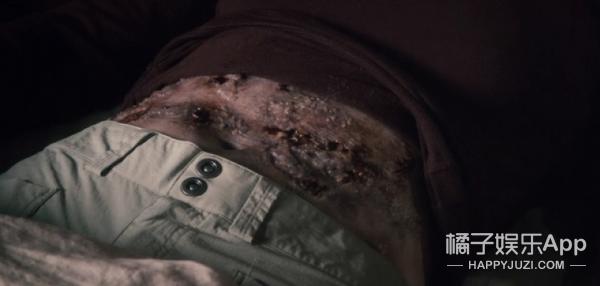 友情提示：密集恐惧者慎入