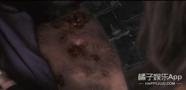 友情提示：密集恐惧者慎入