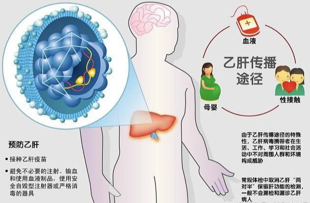 查乙肝病毒DNA一般花费多少钱？主要跟医院的级别有关